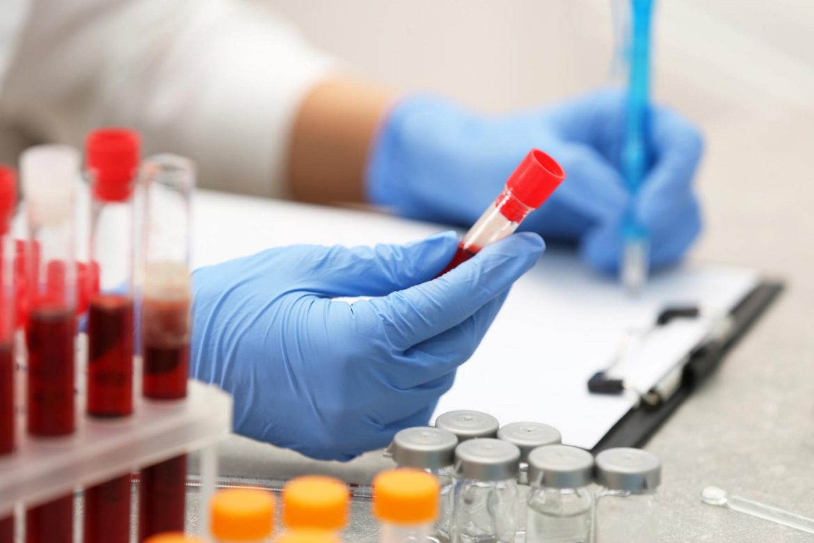 The importance of early detection: Lyme disease test kits explained