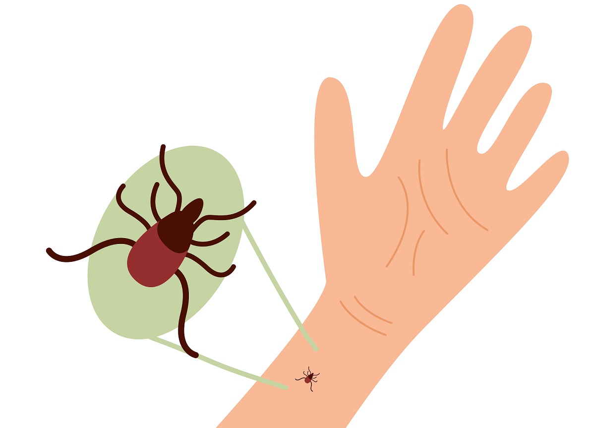 Lyme disease test kits