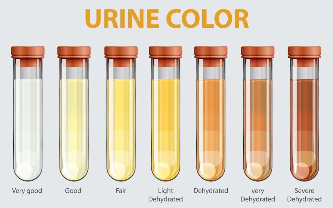 Smartphone urine analysis: instant health insights at your fingertips
