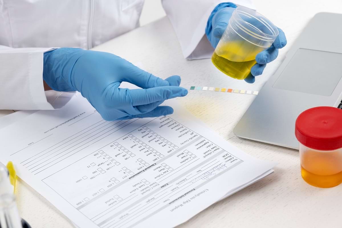urine smartphone test